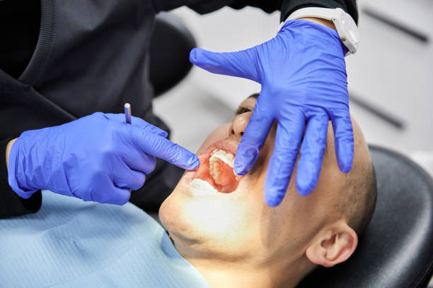 Best Emergency Treatment for Dental Infections or Abscesses in Marbury, AL